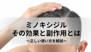 ミノキシジルの効果と副作用、効果的な飲み方とは？